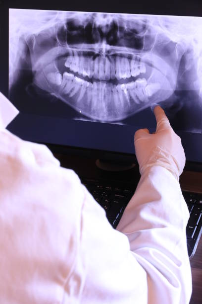Best Emergency Gum Treatment in Reidville, SC