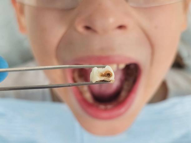Best Cosmetic Emergency Dentistry in Reidville, SC