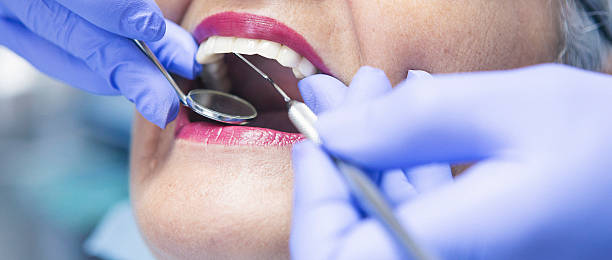 Best Emergency Treatment for Dental Infections or Abscesses in Reidville, SC