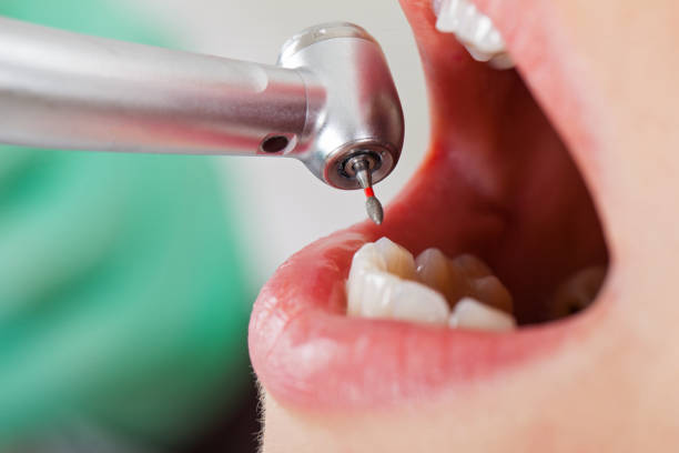 Best Emergency Dental Care for Broken or Chipped Teeth in Reidville, SC